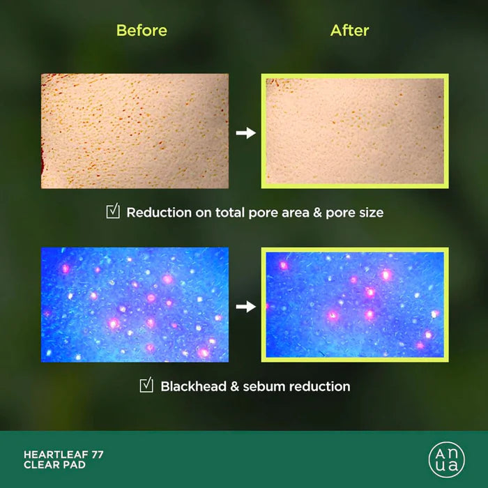 ANUA HEARTLEAF 77 CLEAR PAD