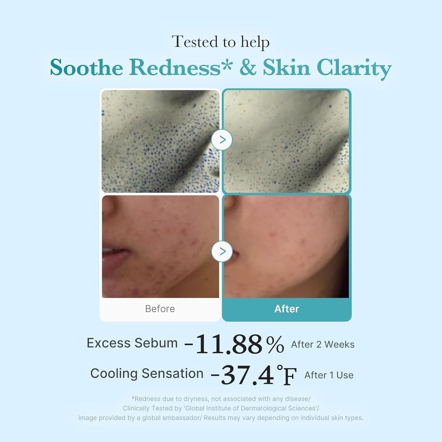 MEDICUBE AZELAIC ACID NIACINAMIDE CLEAR TONER