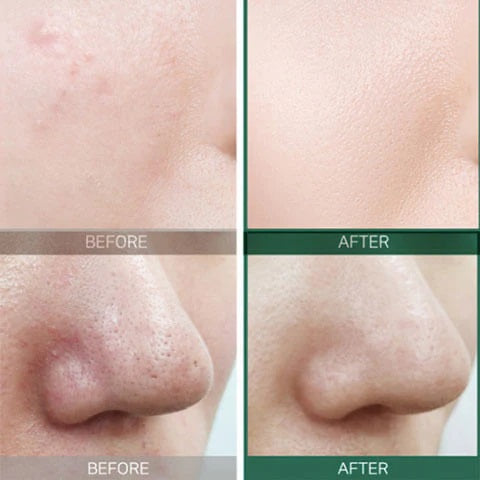 SOME BY MI AHA BHA PHA 30 DAYS MIRACLE TONER 150ml