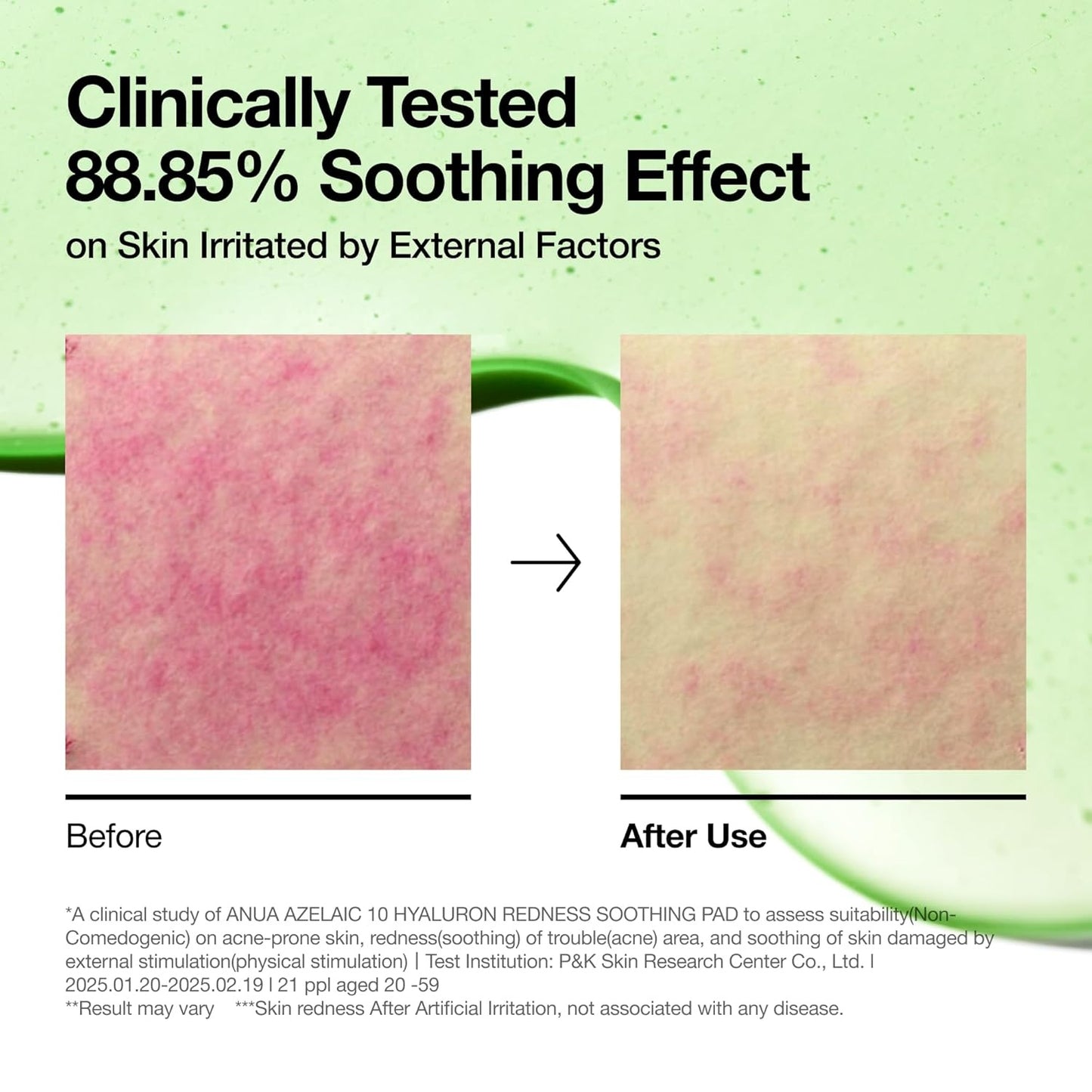 ANUA AZELAIC ACID 10 HYALURON REDNESS SOOTHING PAD