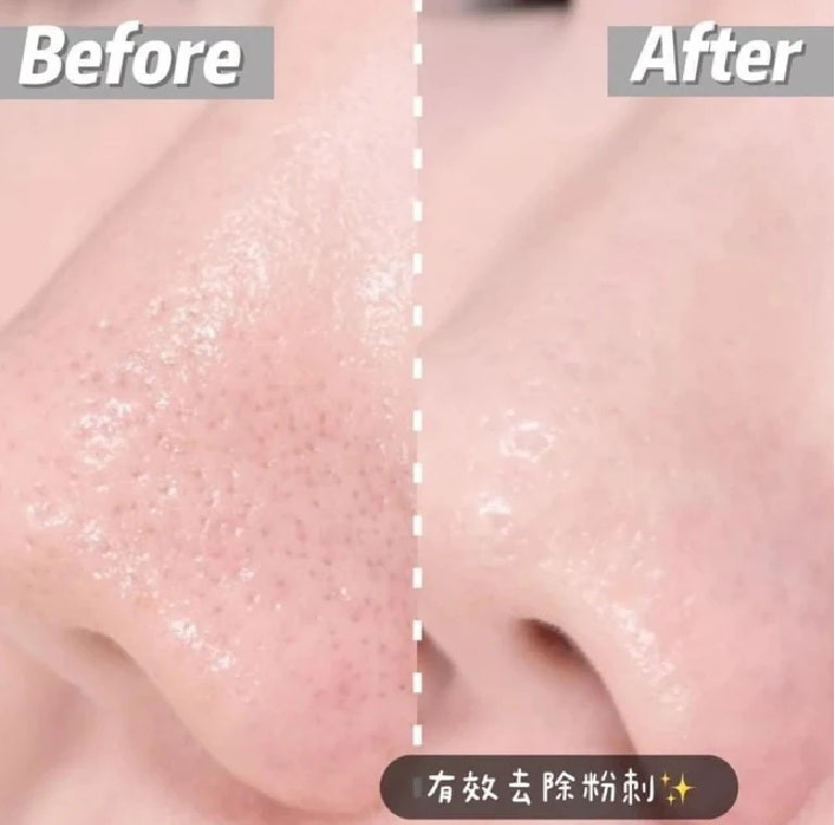 DONG-A PHARM ACLEAN GEL