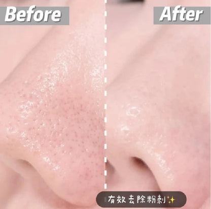 DONG-A PHARM ACLEAN GEL