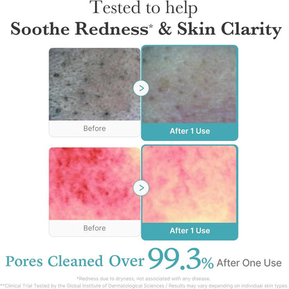 MEDICUBE AZELAIC ACID NIACINAMIDE DEEP CLEAN FOAM CLEANSER