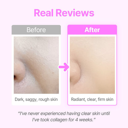 NEAR GLOW COLLAGEN CHEWS PINEAPPLE AND ORANGE FLAVOR