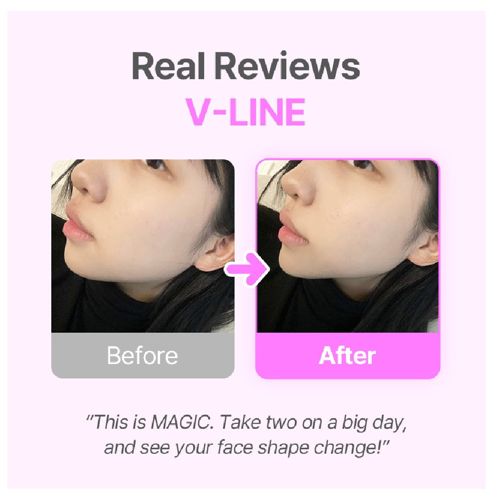 NEAR V-LINE CHEWS PINEAPPLE FLAVOUR