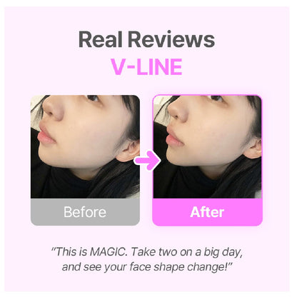 NEAR V-LINE CHEWS PINEAPPLE FLAVOUR