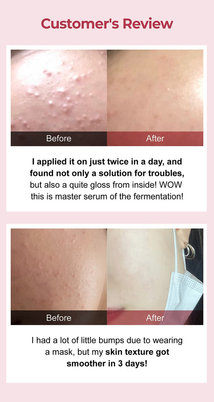 NUMBUZIN NO.3 SKIN SOFTENING SERUM 50ml