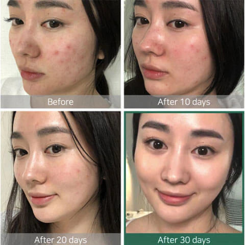 SOME BY MI AHA BHA PHA 30 DAYS MIRACLE TONER 150ml