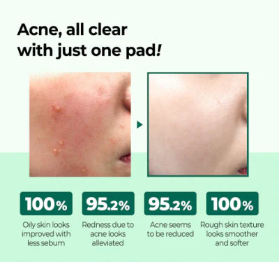 SOME BY MI AHA BHA PHA 30 DAYS MIRACLE TRUECICA CLEAR PAD - 70 PADS